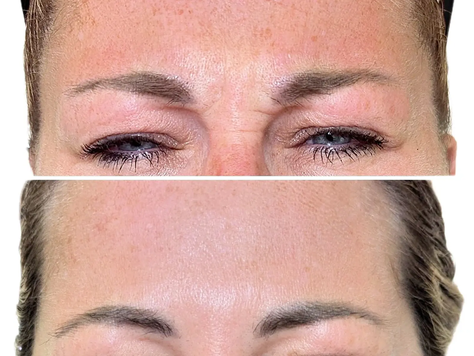 Anti-Wrinkle Treatment & Consultation at Mona Aesthetics