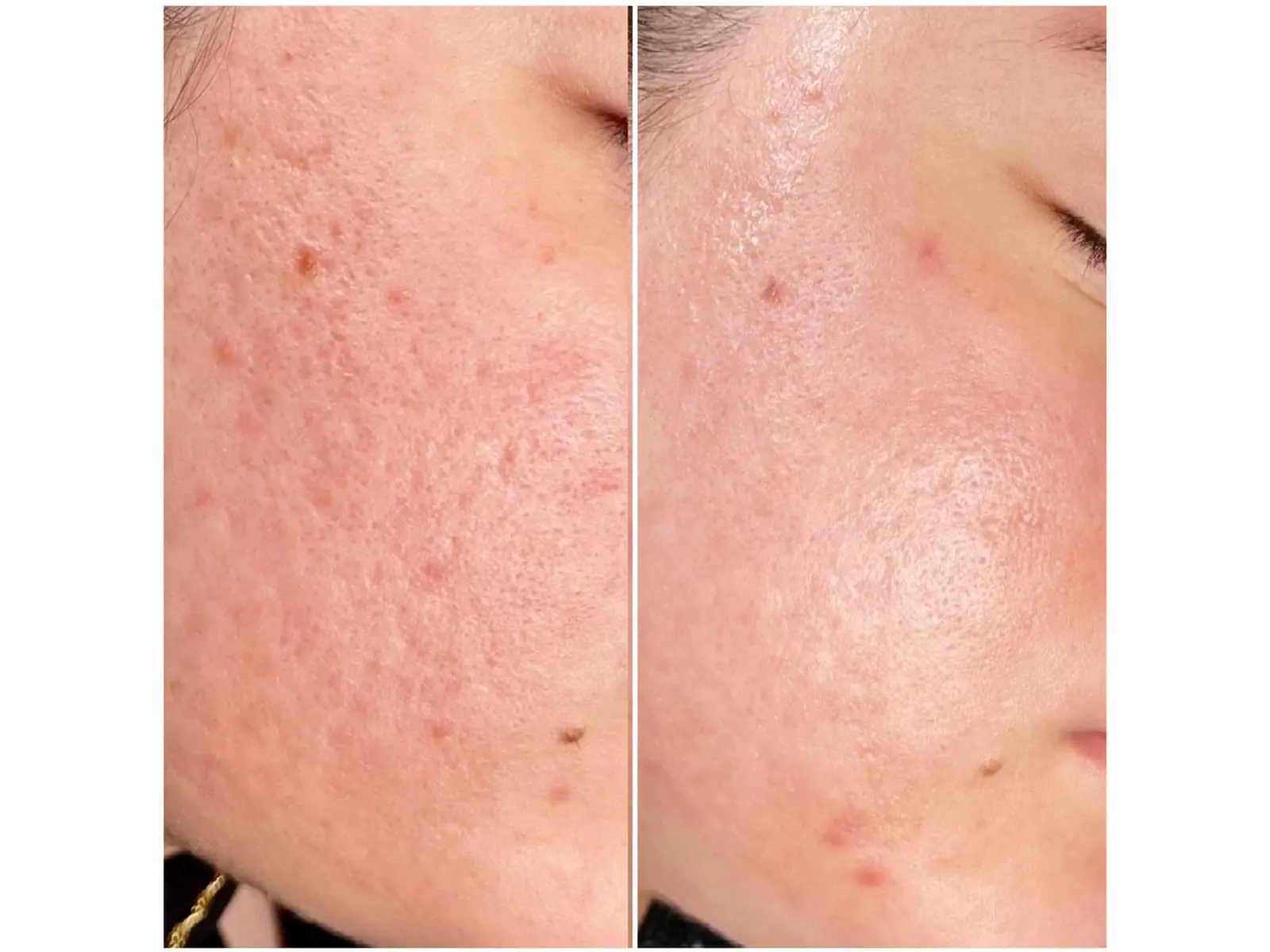 Skin Treatments at Mona Aesthetics